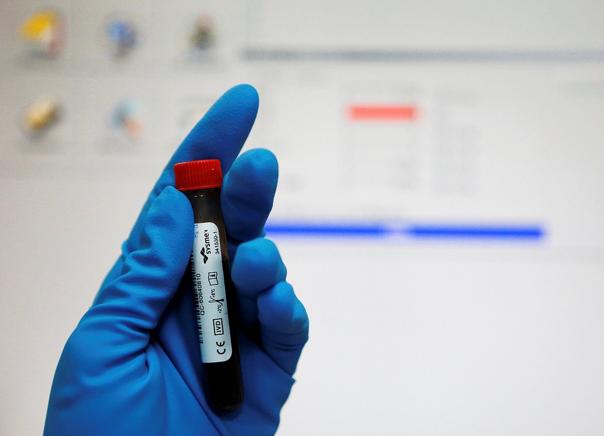 Understanding negative drug tests: detection methods and timelines explained