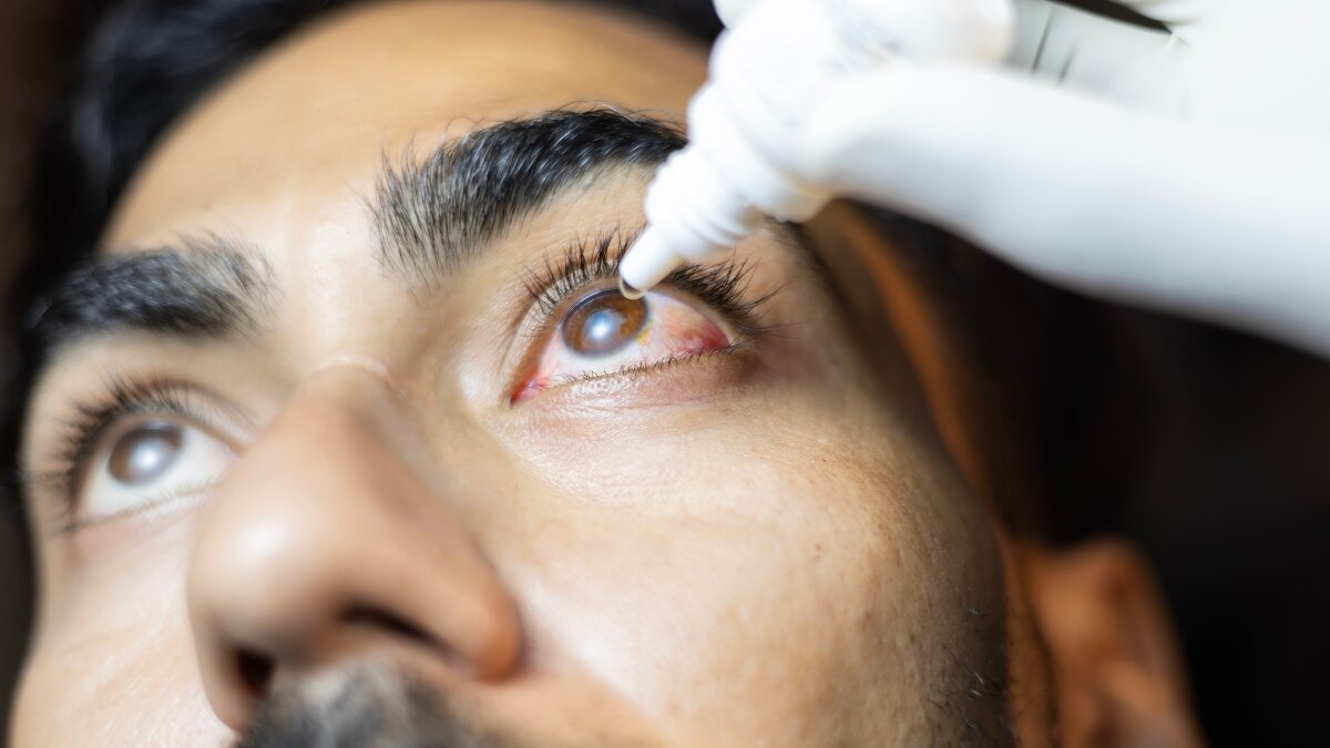 Eye irritation surging in Delhi-NCR: When to rinse, when to seek help