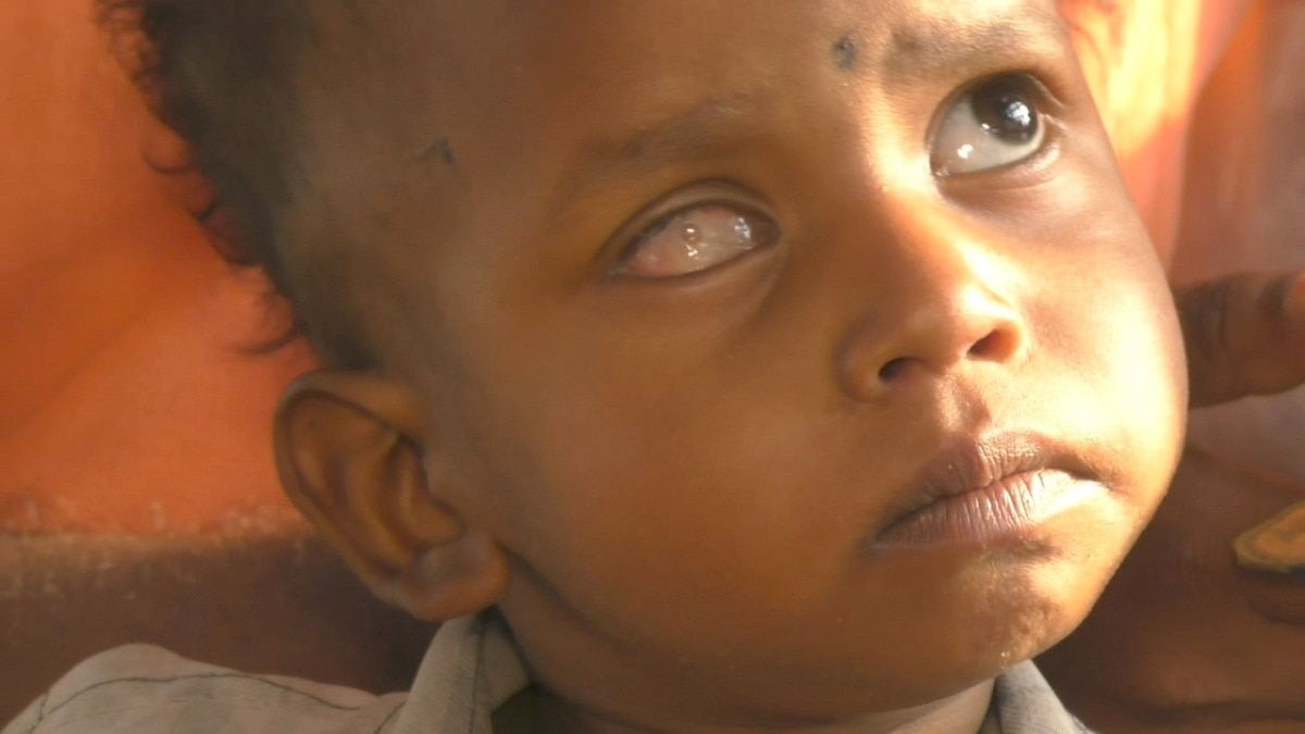 Train cancellations stall eye treatment for four-year-old in Uttar Pradesh