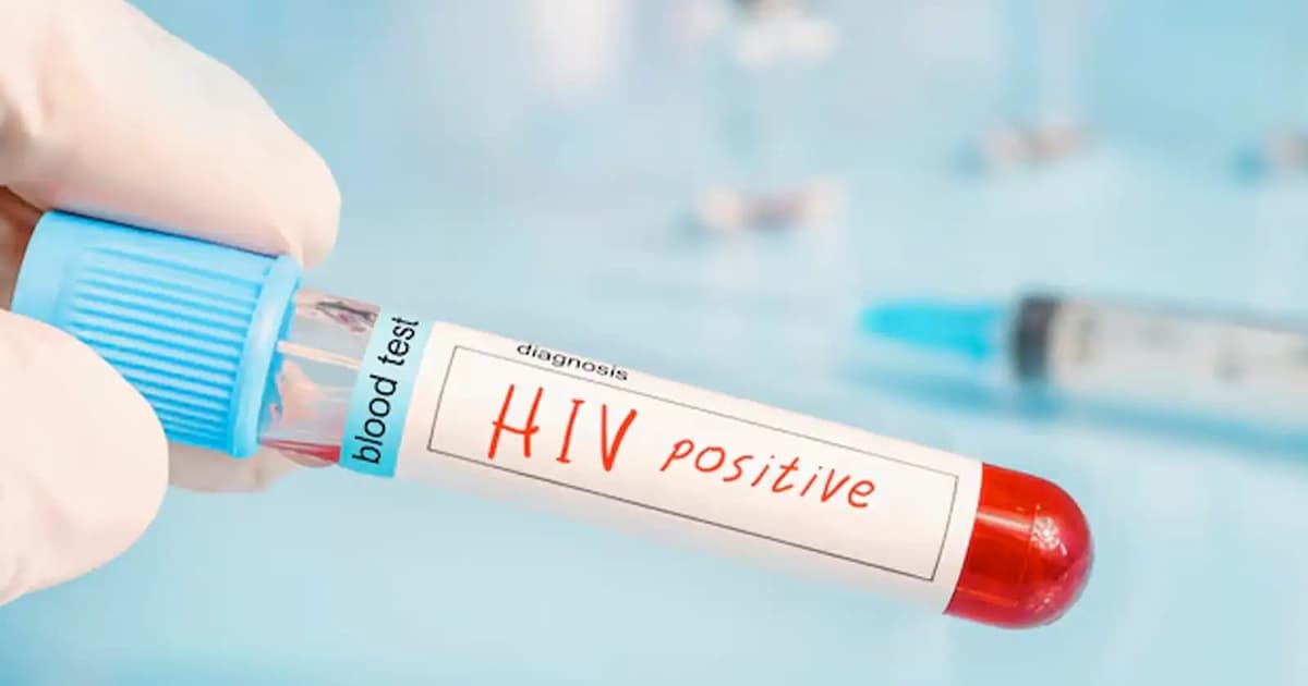 Fiji isytihar krisis HIV apabila kes diagnosis melonjak drastik