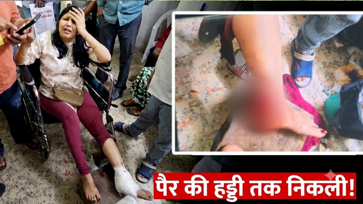 भोपाल में अग्निशमन ड्रिल के दौरान महिला घायल, फायरब्रिगेड दल पर व्यापारियों का आक्रोश