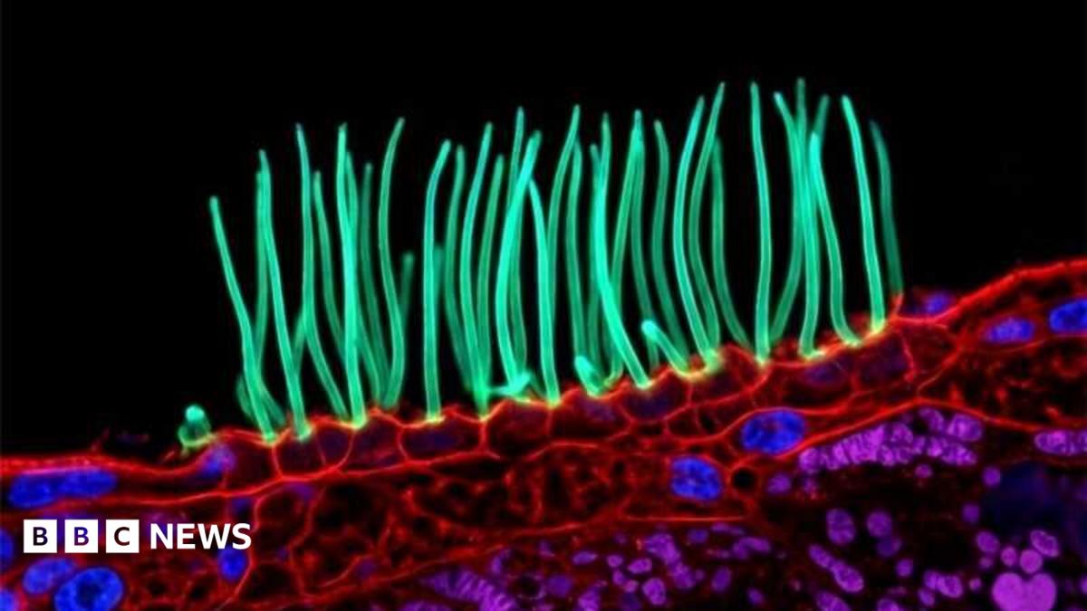 Microscopy image sparks controversy in prestigious Nikon photography contest