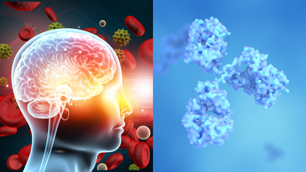 Scientists identify tau protein hotspot; chemical marker halts clump formation