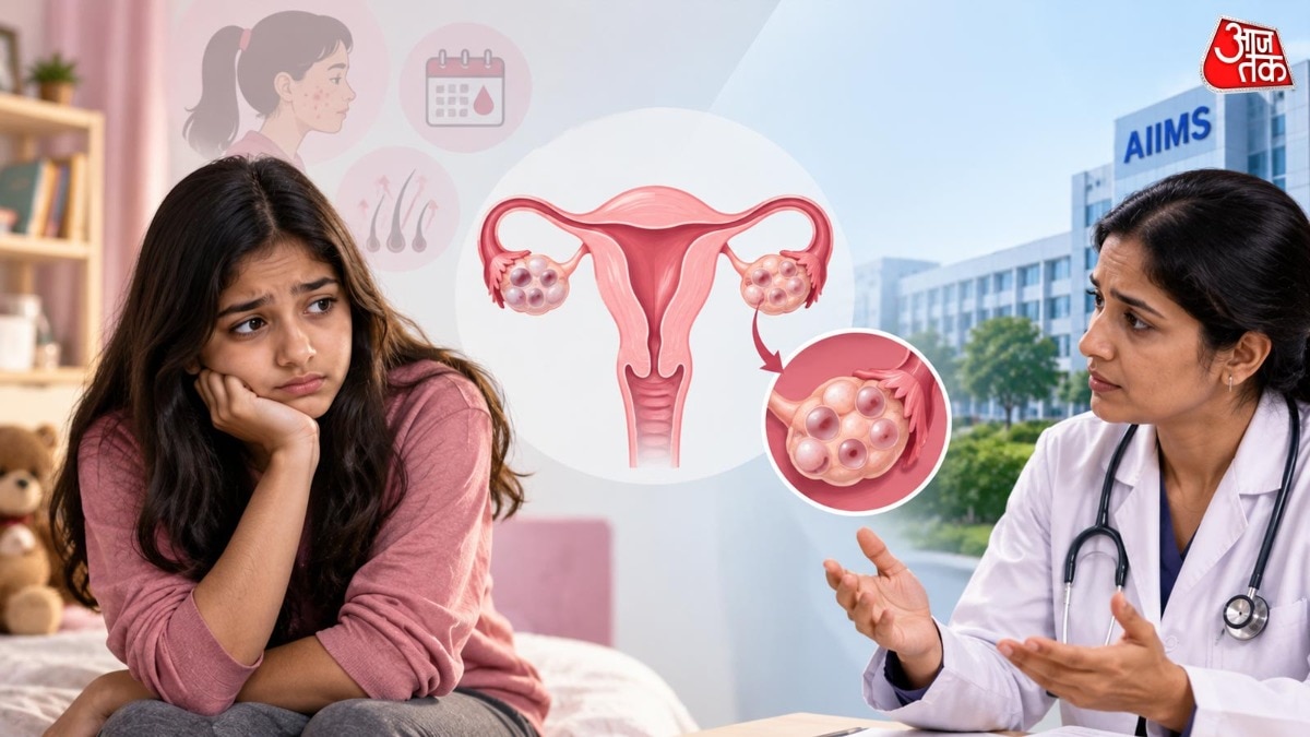 PCOS Cases Rising Among Indian Girls as Young as 11, AIIMS Warns