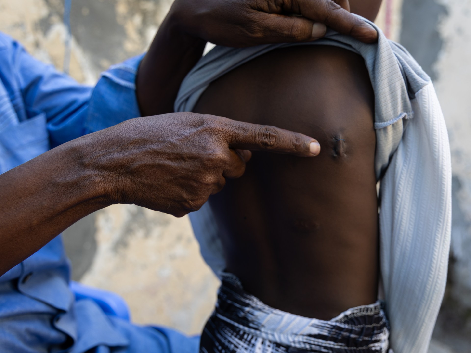 Civilian toll mounts as US intensifies air campaign in Somalia