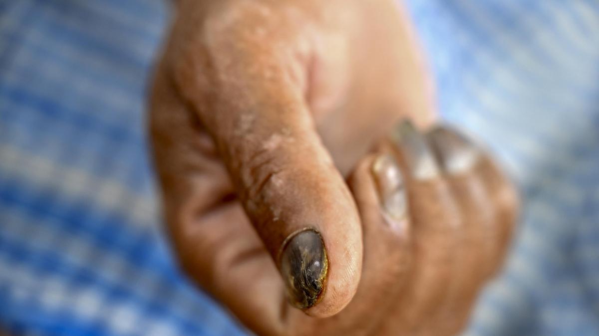 Chromium contamination spreads through groundwater in UP villages