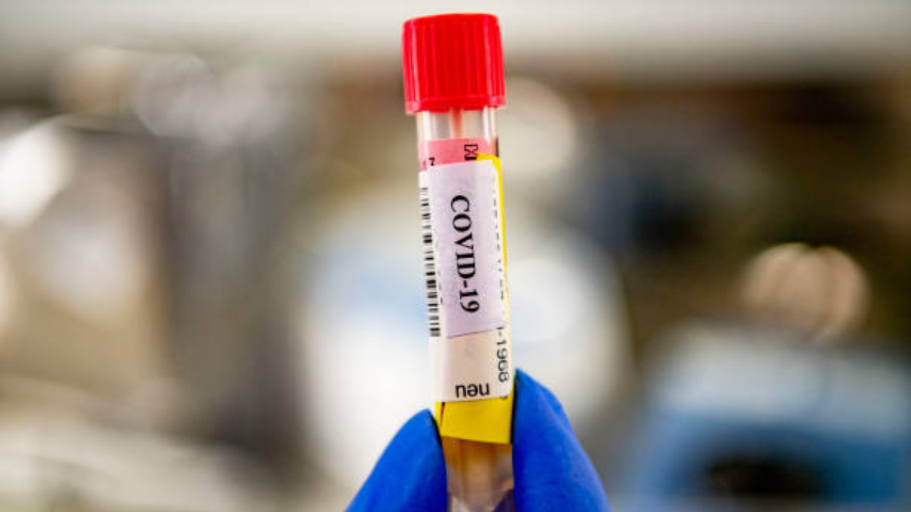 Indian-origin lab owner charged in US for $66 million Covid fraud scheme