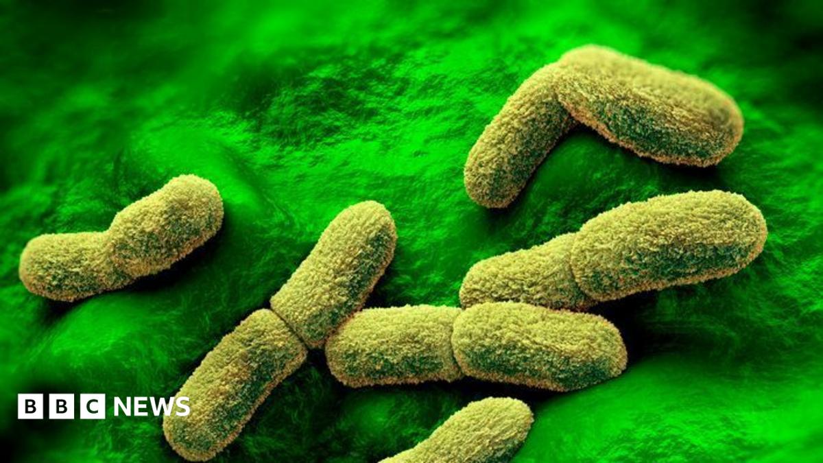 US monitoring death of Russian plague researcher in Siberia