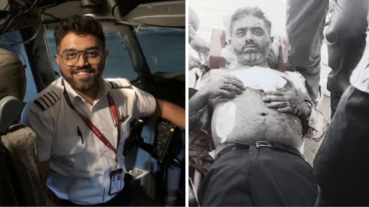 Indian Pilot Assaulted Mid-Flight Shows Injuries After Heroic Response