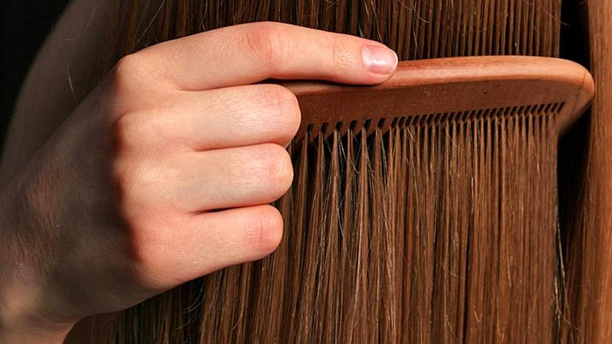 Kerala hospital removes 1kg hairball from girl's stomach in rare surgery