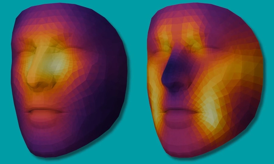 AI system predicts cancer survival risk from facial photos
