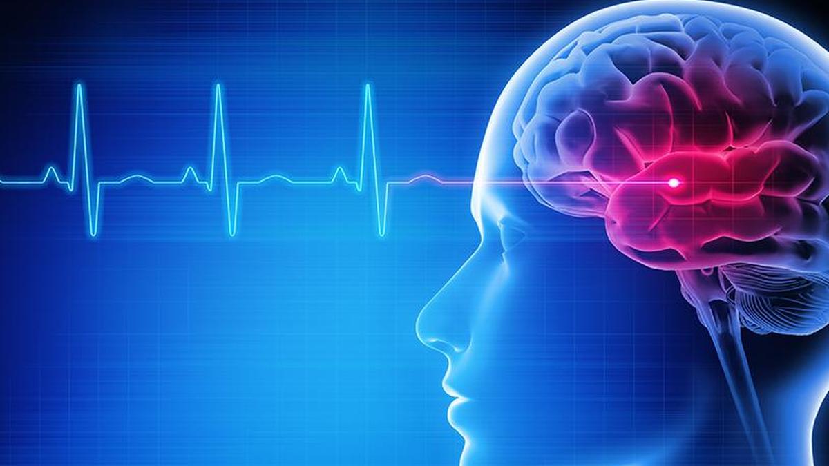 Stroke cases dominate neurology emergency visits across Karnataka