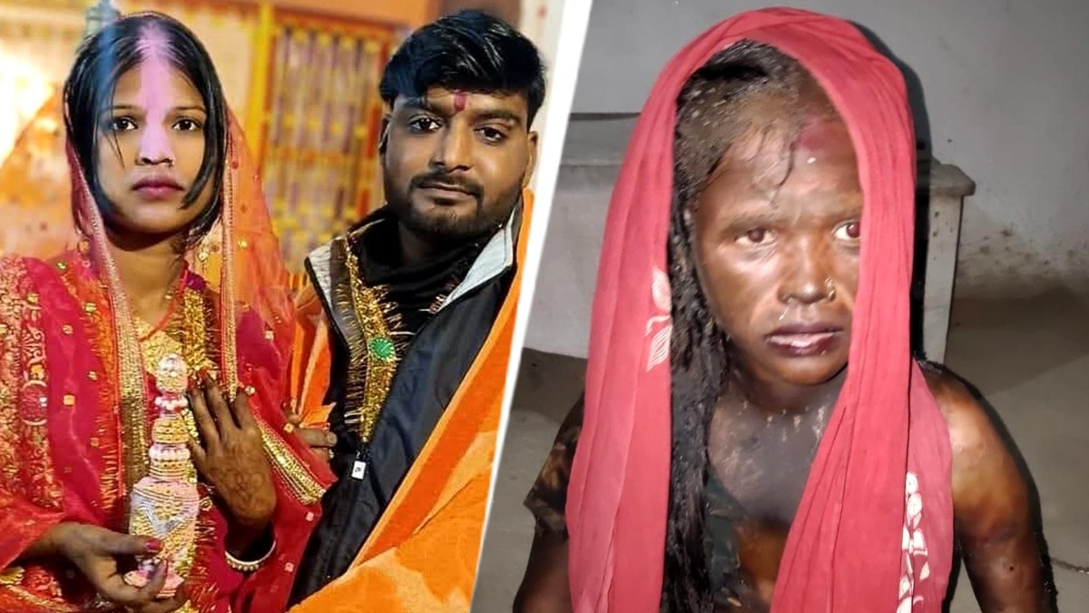 Woman dies after being set on fire by husband in Bihar; marital dispute suspected