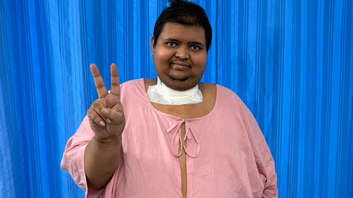 Delhi man loses 61 kg in month following bariatric surgery