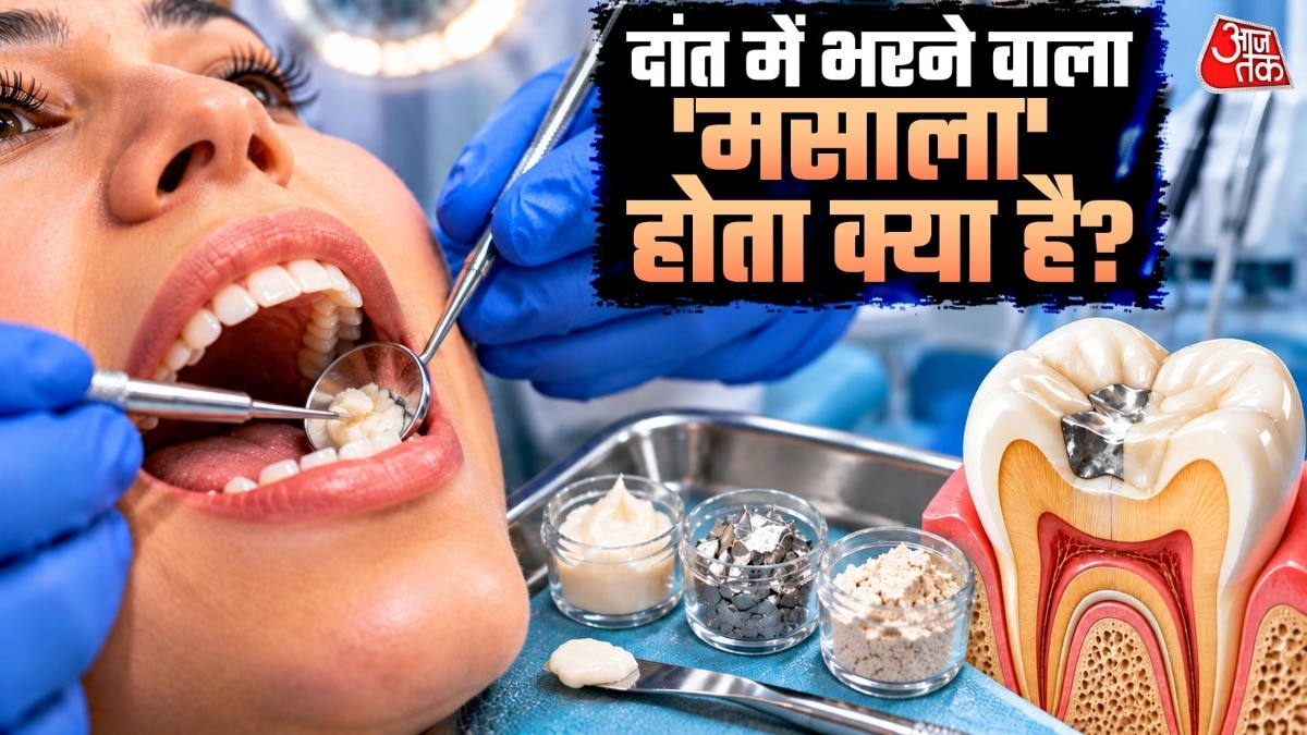 What's Inside Dental Fillings? Understanding Common Cavity Treatment Materials