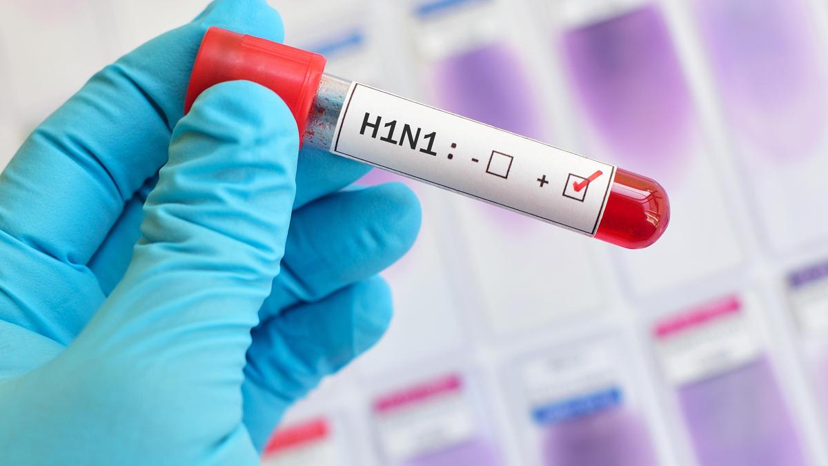 Health officials issue alert over H1N1 influenza transmission risk