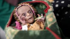 Newborn twins battle malnutrition as Yemen's conflict deepens hunger crisis