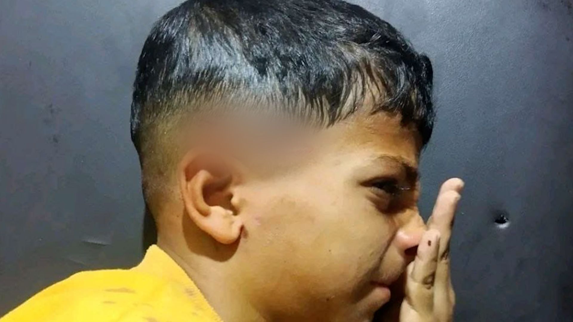 Palestinian boy survives head wound in confrontation with Israeli forces
