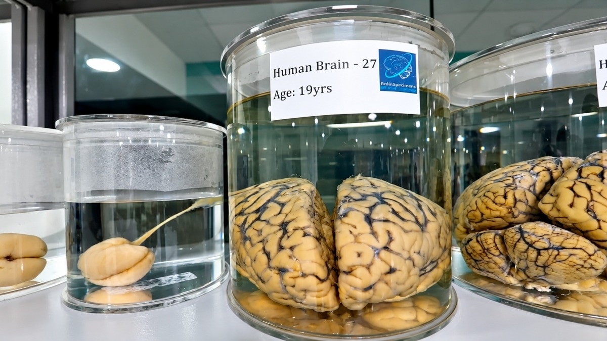 IIT-Madras tasked with creating India's largest 3D brain map atlas