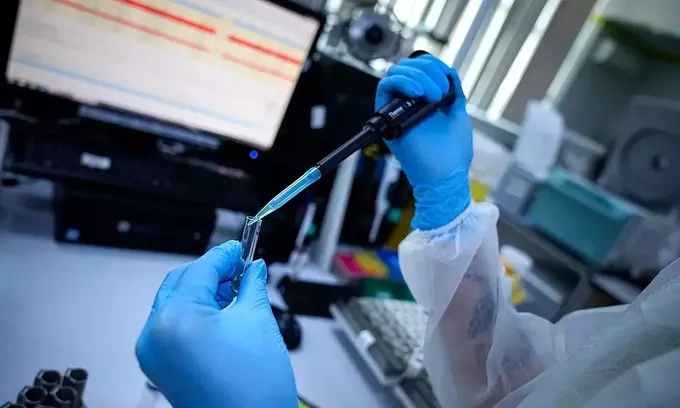 Russian lab technician dies after plague bacteria test tube accident