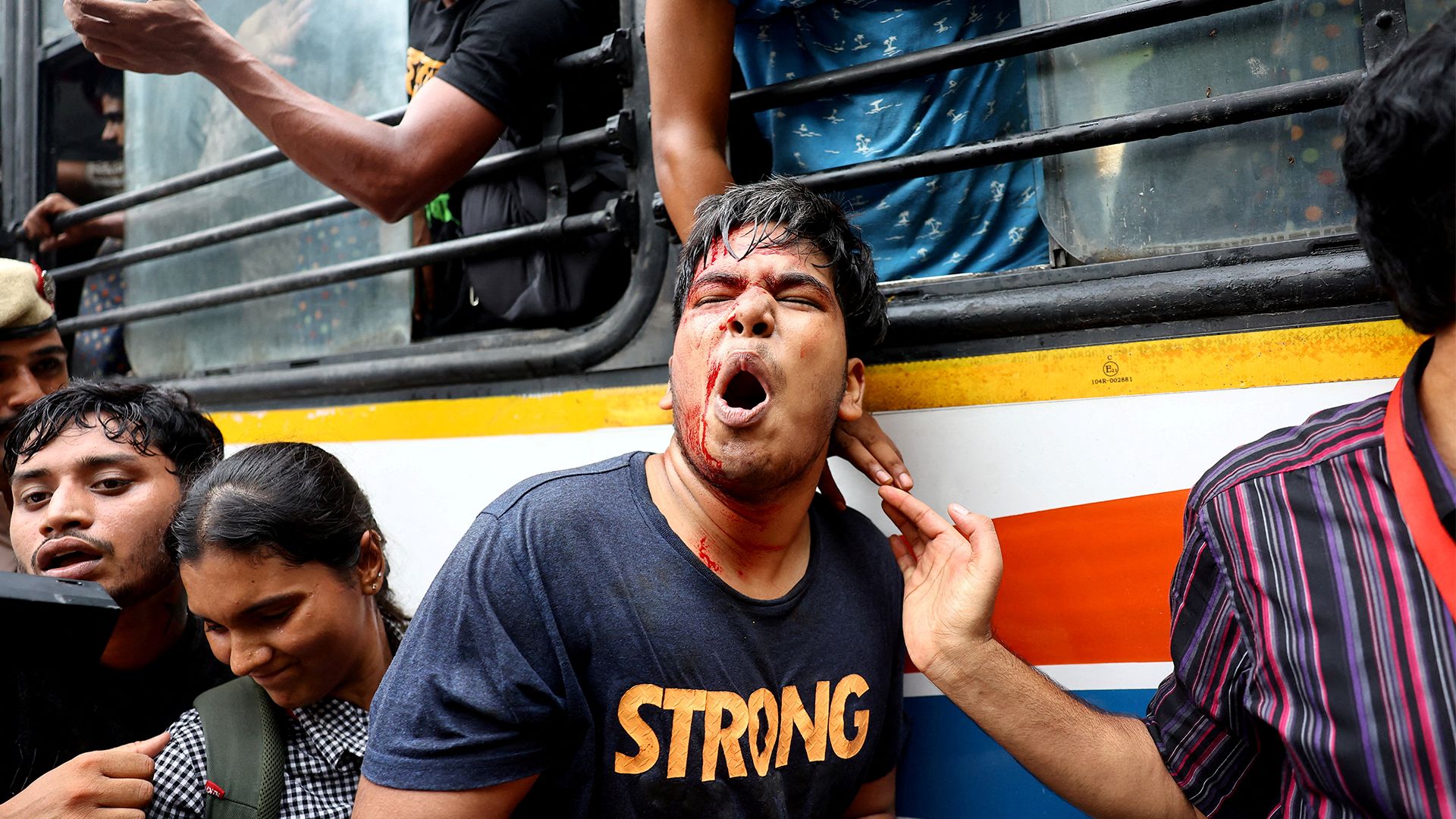 Amnesty International accuses India of using lethal force against protesters