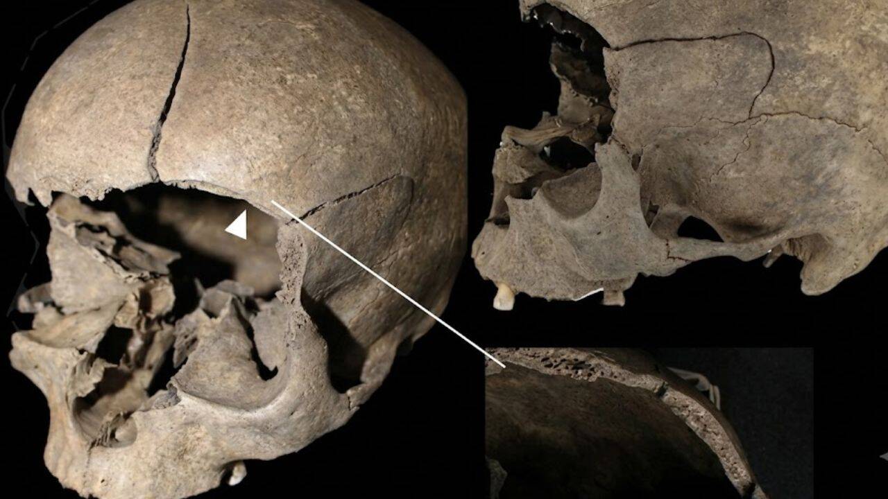 Medieval Scandinavian burials reveal widespread violence and trauma