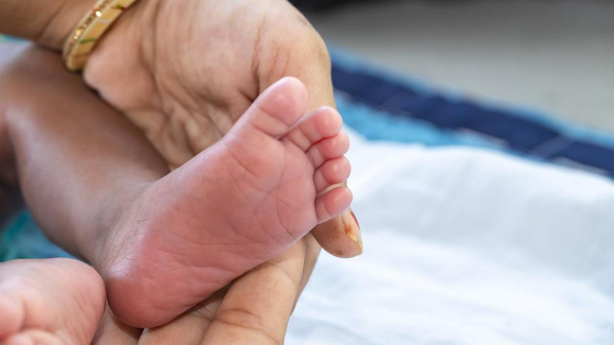 Tamil Nadu government hospitals lack genetic tests for intersex infants