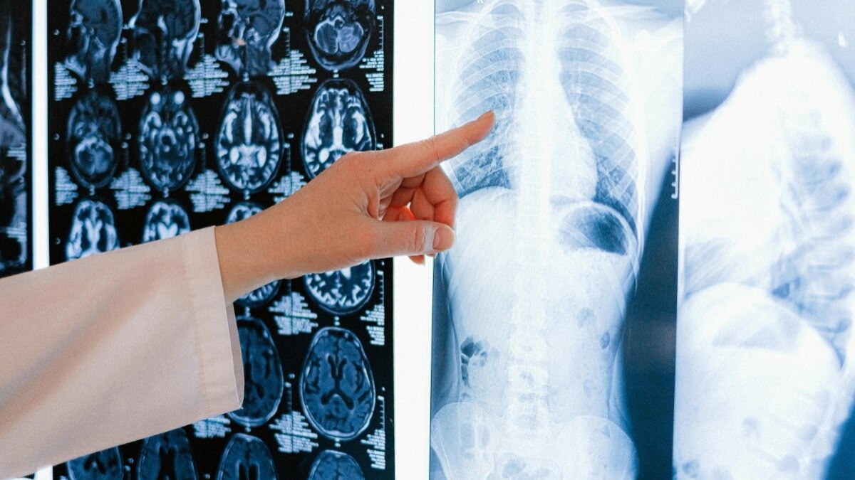 Breathlessness: How to distinguish between heart and lung disease