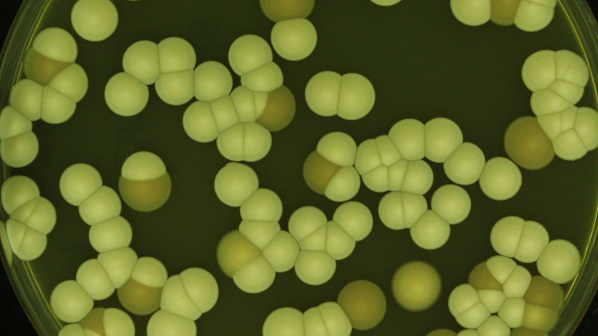Scientists reassess antifungal strategy as fungi develop dual resistance mechanisms
