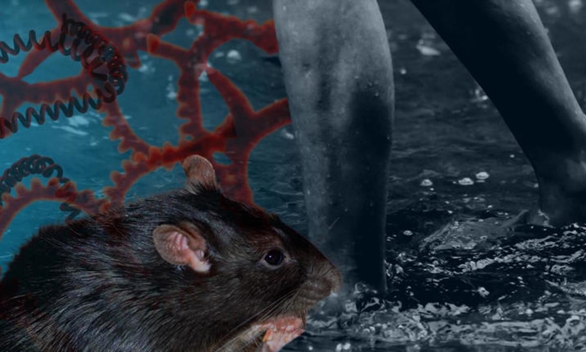 Manila declares leptospirosis situation an epidemic as cases surge