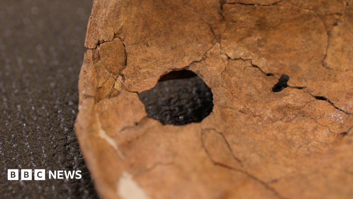 Ancient Neanderthal wound hints lethal violence shaped early human societies