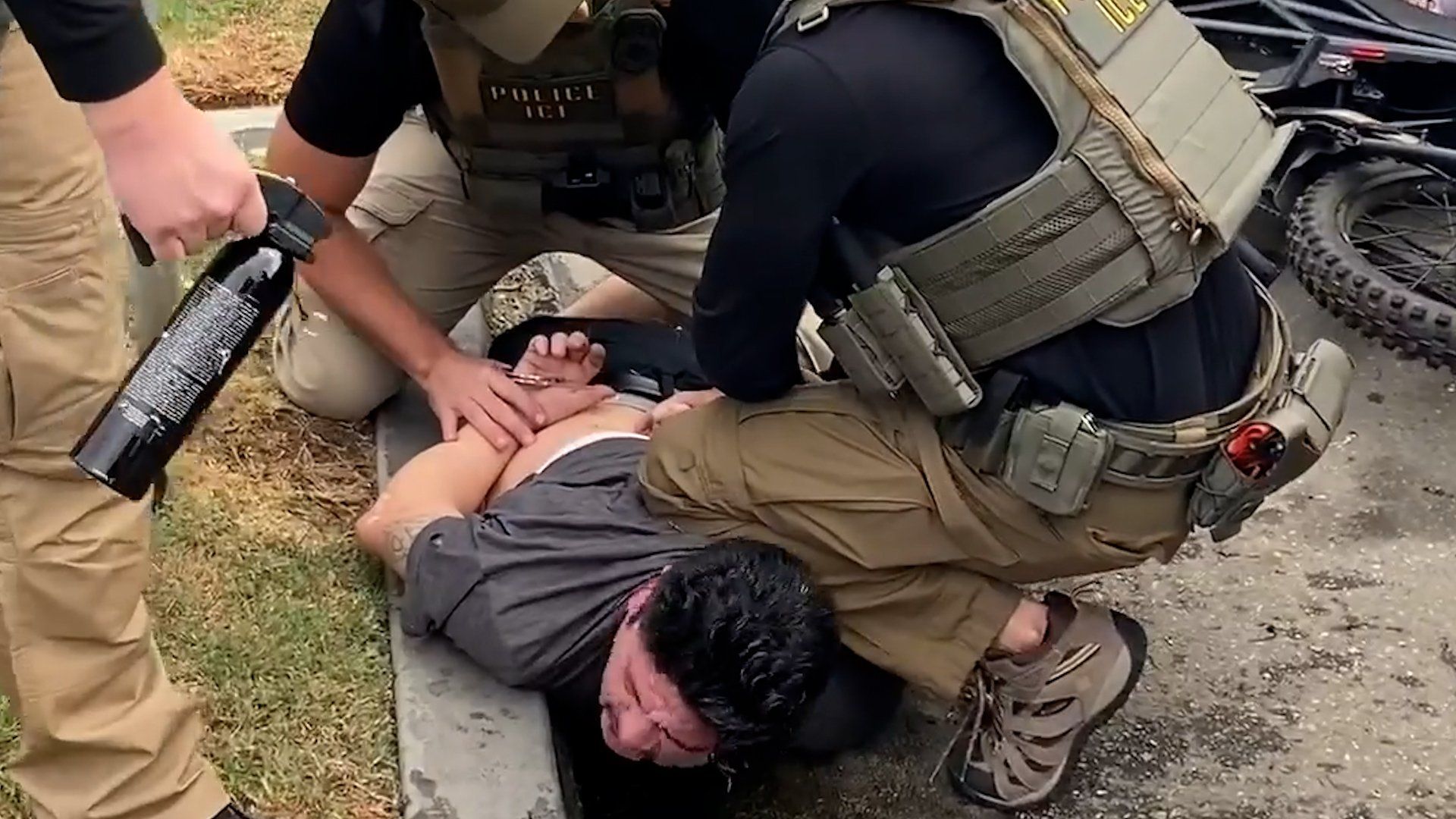 Man alleges arm fracture during ICE detention in California