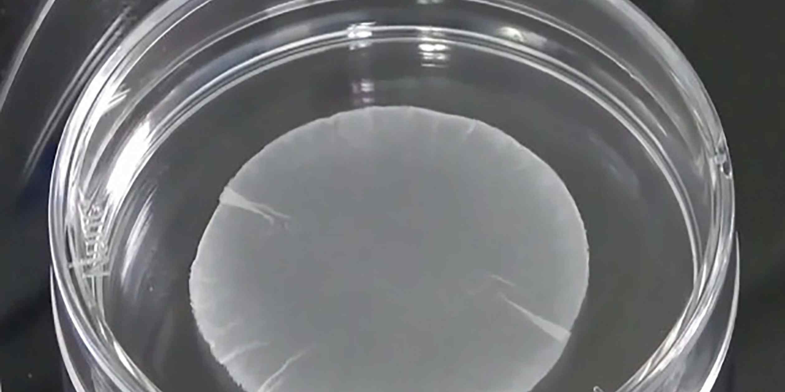 Japan approves insurance coverage for stem cell heart patch