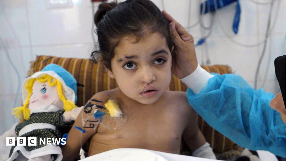 Gaza girl undergoes multiple surgeries after disputed strike