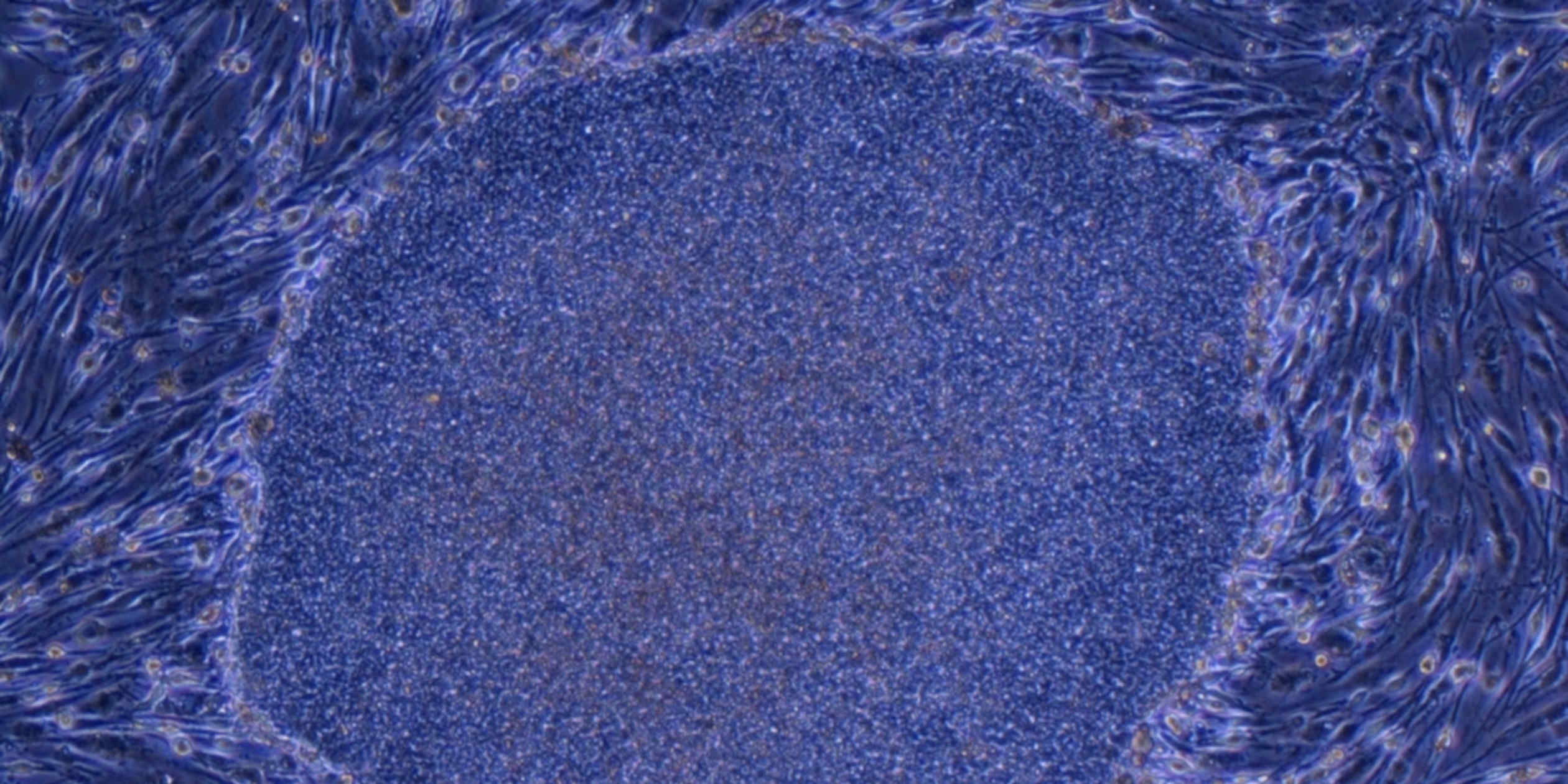 Japan pursues advanced iPS cell therapy for stroke and kidney disease