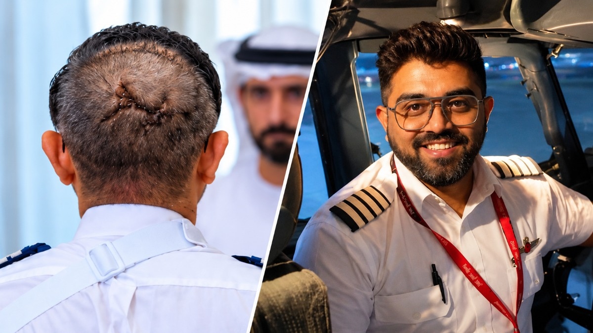 Indian pilot's miraculous survival defies medical odds in aircraft accident