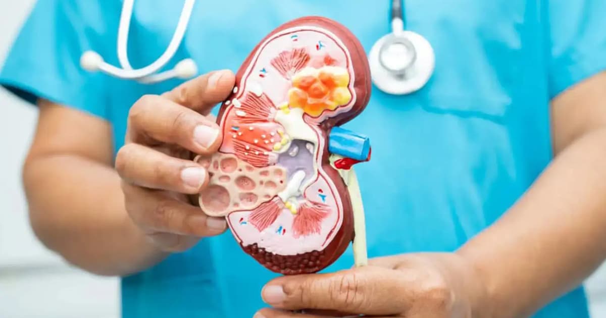 Kanser buah pinggang sering tanpa gejala sehingga terlambat dikesan