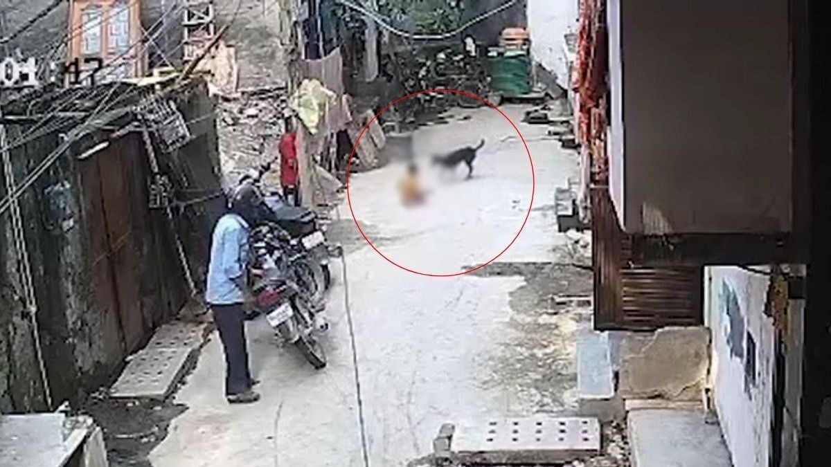 दिल्ली में आवारा कुत्ते का आतंक: 18 महीने के बच्चे को गंभीर चोटें