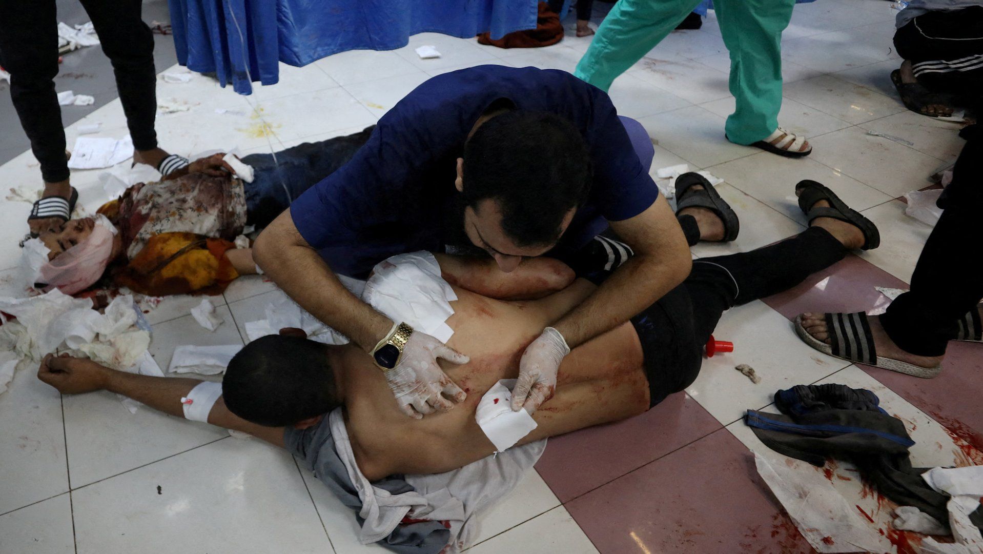 Medical volunteers describe overwhelming challenges in Gaza hospitals