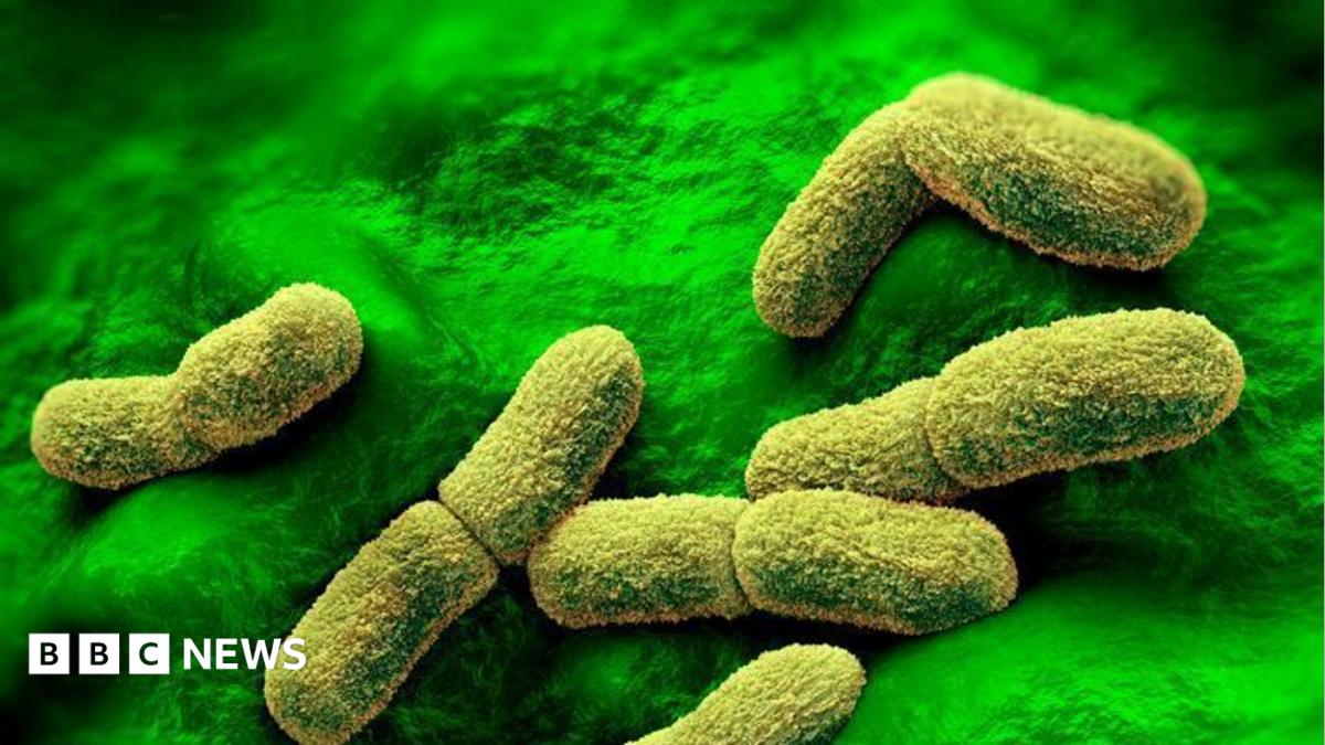 US monitoring death of plague researcher at Siberian facility