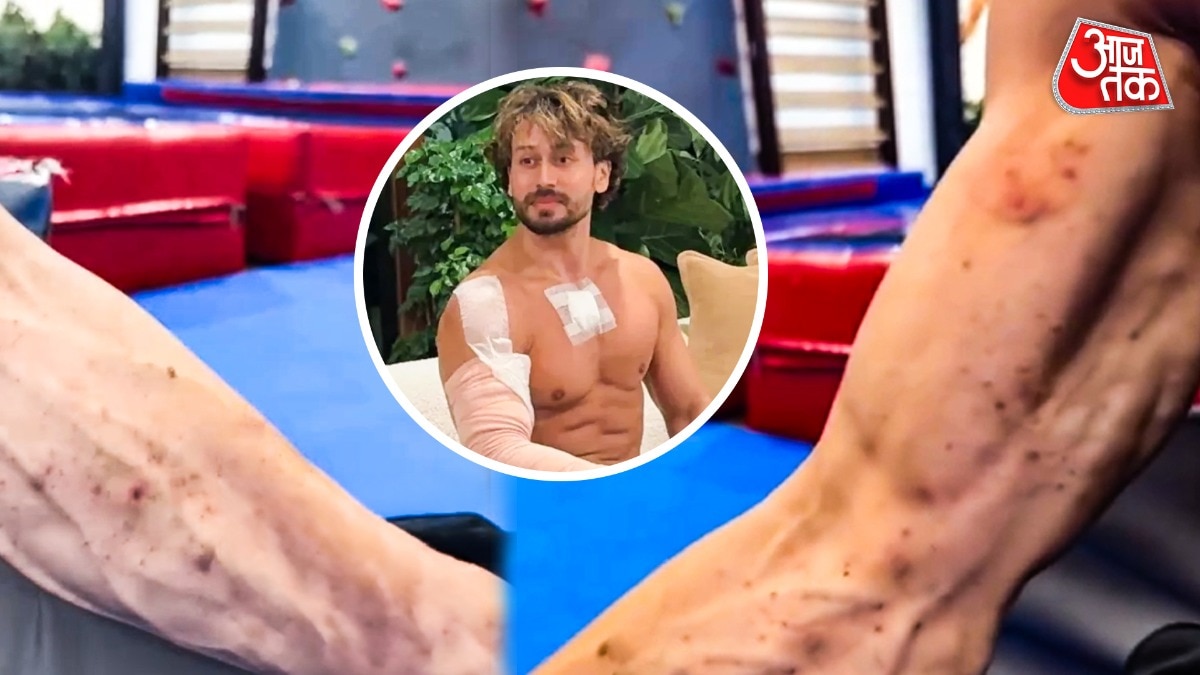Tiger Shroff's Team Releases Video of Injuries from October Shooting Incident