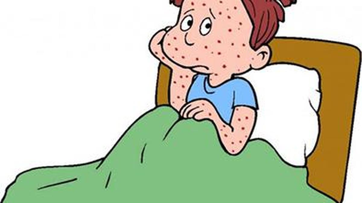 Cusat engineering school moves classes online after chickenpox cases