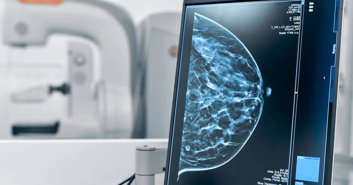 Tumor Ganas Rekrut Saraf Badan untuk Mempercepat Pertumbuhan