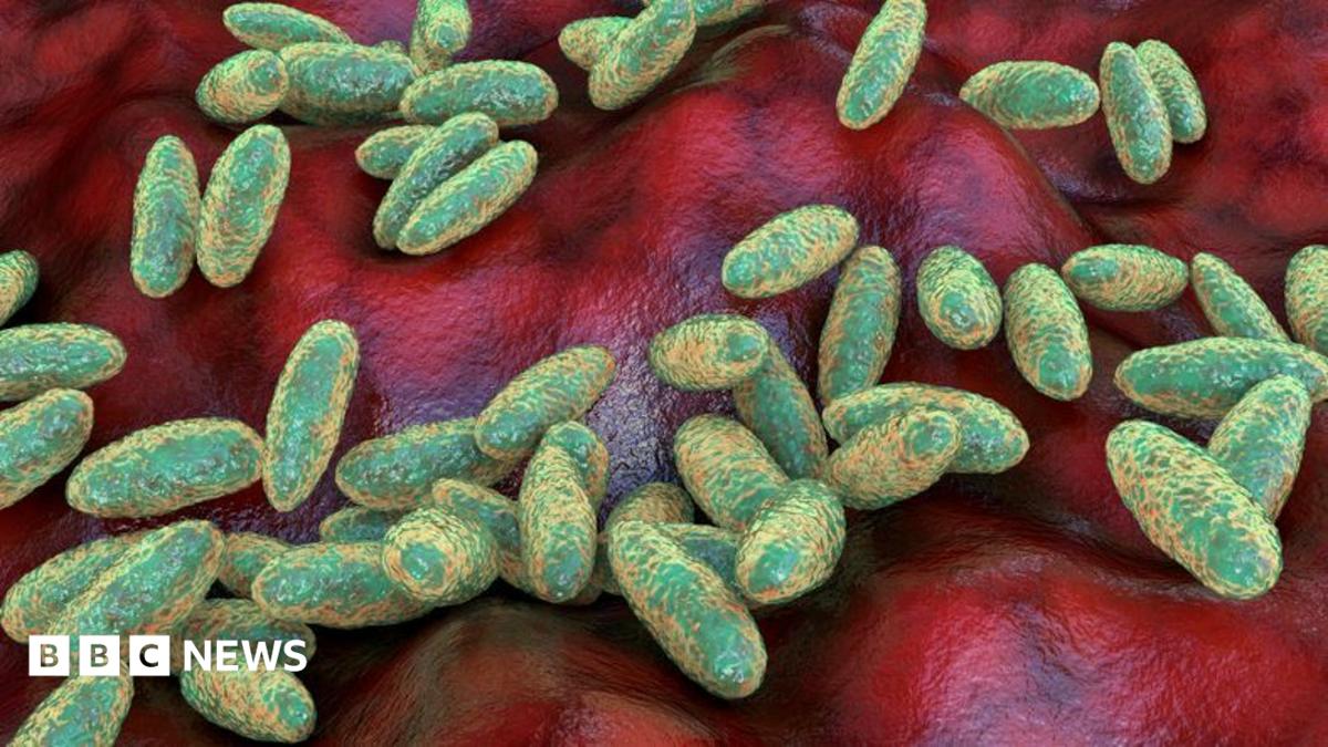 Russian Lab Worker's Death Raises Questions About Plague Disease