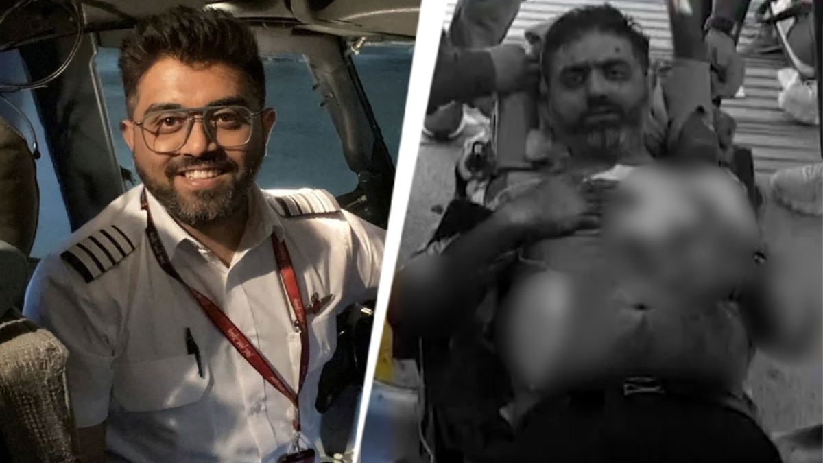 दंत चिकित्सक ने स्मित मछ्छर को बचाने के लिए 45 मिनट की कड़ी मेहनत की