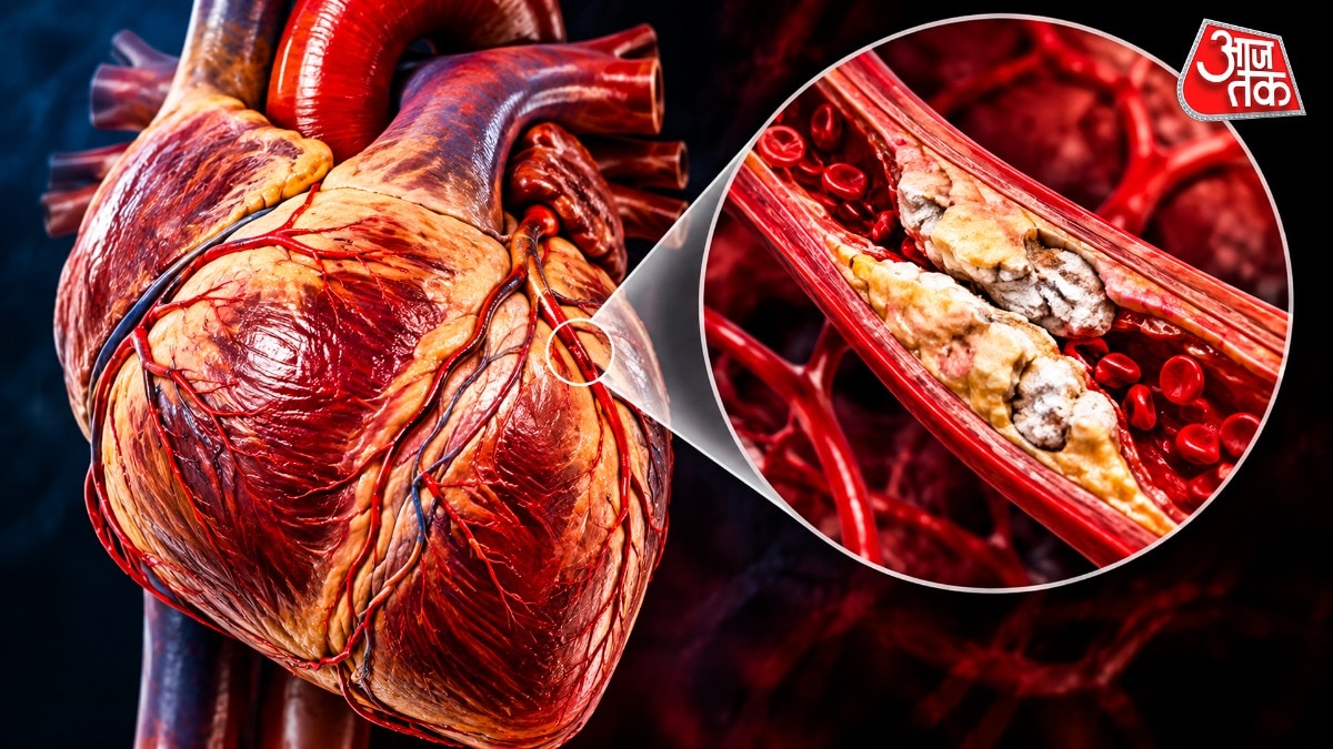High calcium intake linked to heart attacks, experts outline prevention strategy