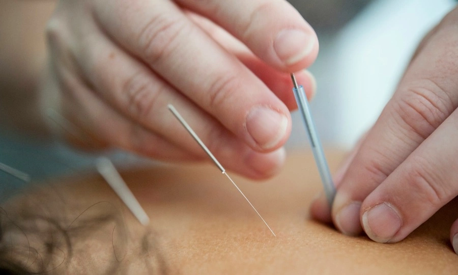 South Korean court fines acupuncturist after elderly patient's fatal heart injury