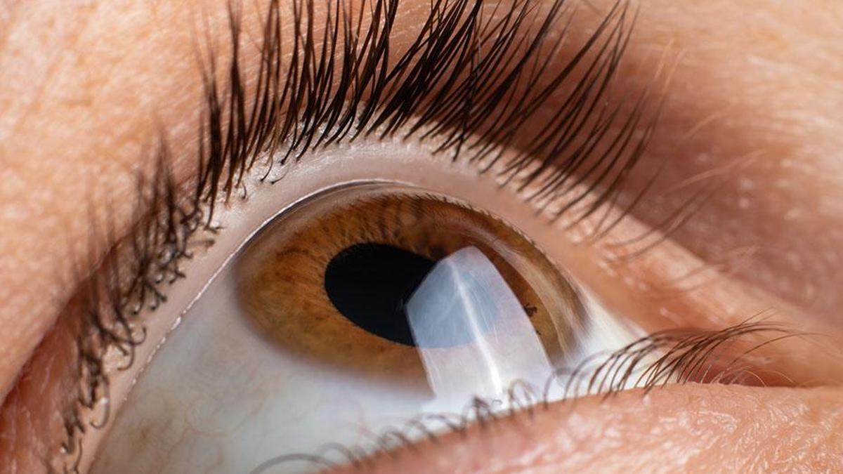 Medical college emphasizes critical importance of eye donation