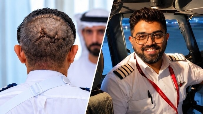 Indian pilot survives axe attack in cockpit with life-threatening head fracture