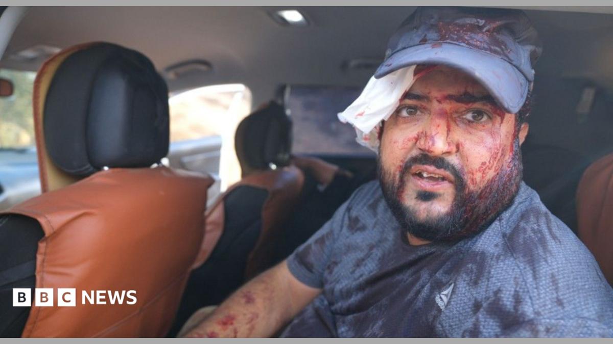 Israeli settlers attack Palestinian farmers, US journalist injured in West Bank